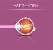 Astigmatism Eye Diagram