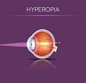 Hyperopia Eye Diagram