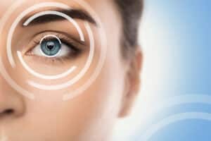 vision correction surgery